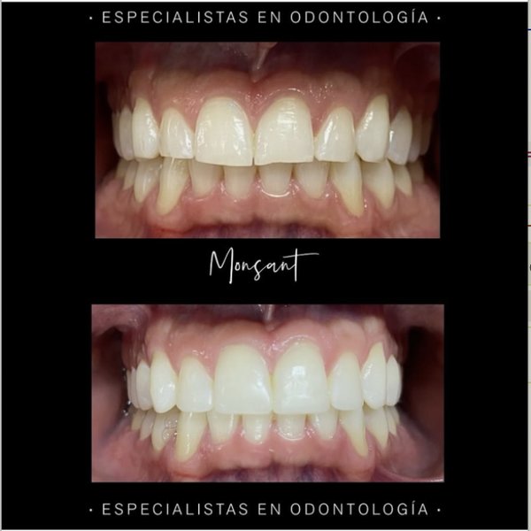 Resultado 2