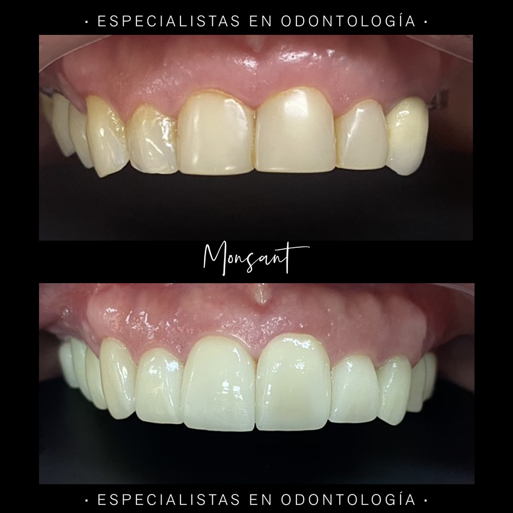 Resultado 4