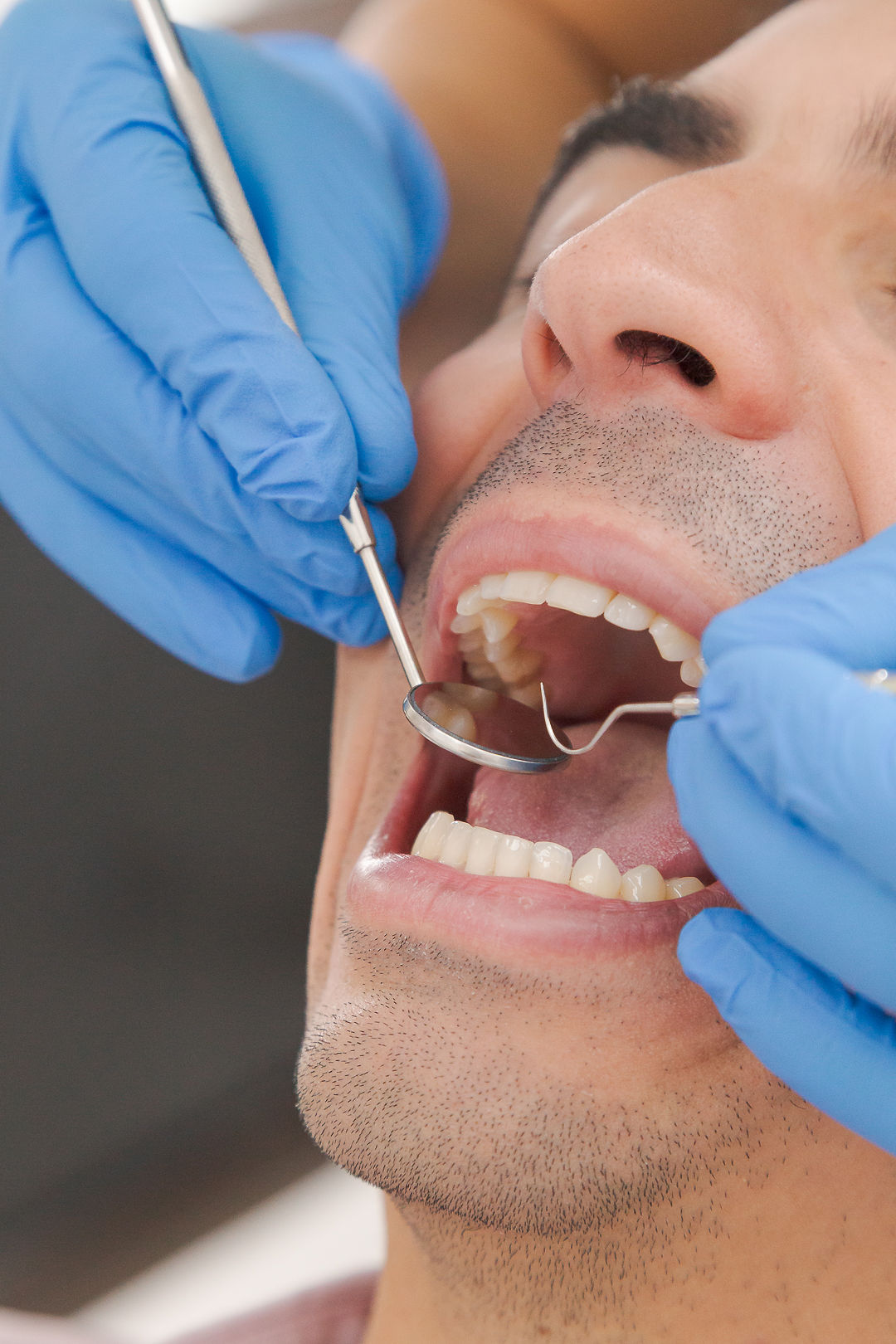 Limpieza dental